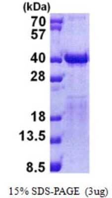 SDS-PAGE: Recombinant Human TFIIS His Protein [NBP2-22877]