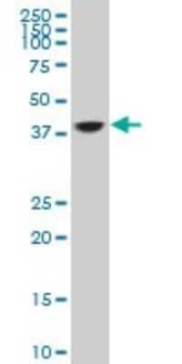 Western Blot: TFIISH Antibody (3B9) [H00006920-M07]