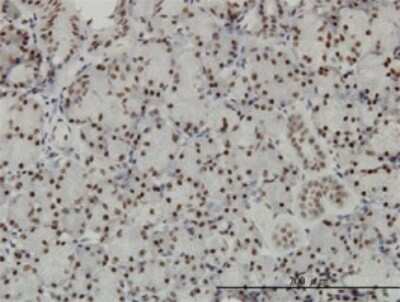 Immunohistochemistry-Paraffin: TFIISH Antibody (4E11) [H00006920-M08]