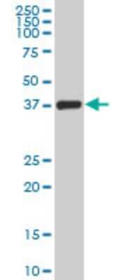 Western Blot: TFIISH Antibody (4E11) [H00006920-M08]