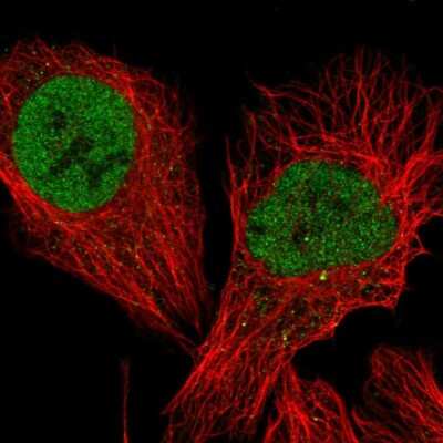 Immunocytochemistry/ Immunofluorescence: TFIISH Antibody [NBP2-58254]