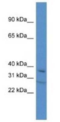 Western Blot: TFIISH Antibody [NBP1-91318]