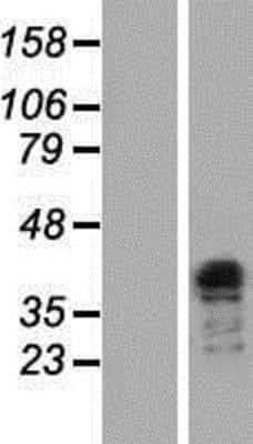 Western Blot: TFIISH Overexpression Lysate [NBP2-08030]