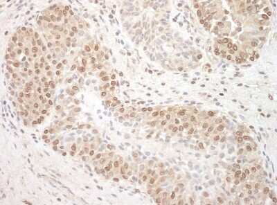Immunohistochemistry: TFIP11 Antibody [NBP1-40364]