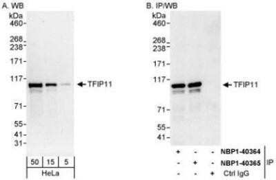 Western Blot: TFIP11 Antibody [NBP1-40364]