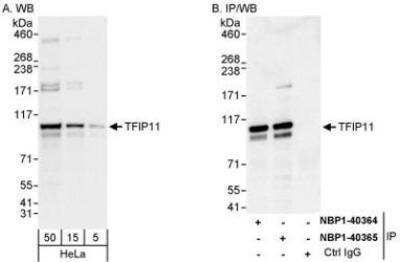 Western Blot: TFIP11 Antibody [NBP1-40365]