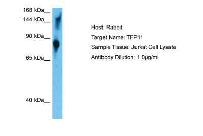 Western Blot: TFIP11 Antibody [NBP2-86861]