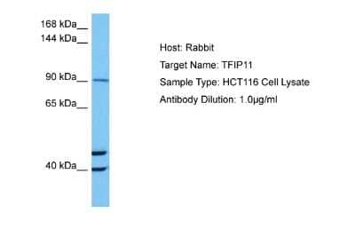 Western Blot: TFIP11 Antibody [NBP2-86862]