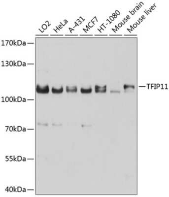 Western Blot: TFIP11 AntibodyBSA Free [NBP2-93034]