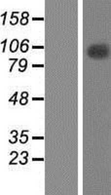 Western Blot: TFIP11 Overexpression Lysate [NBP2-09125]