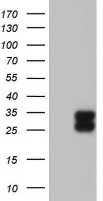 Western Blot: TFPI-2 Antibody (OTI1D4) [NBP2-46100]