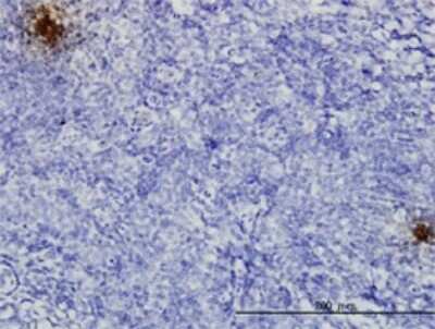 Immunohistochemistry-Paraffin: TFPI-2 Antibody (3E8) [H00007980-M01]