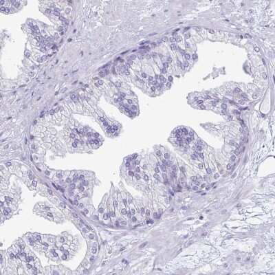 Immunohistochemistry-Paraffin: TFPI-2 Antibody [NBP2-33552]