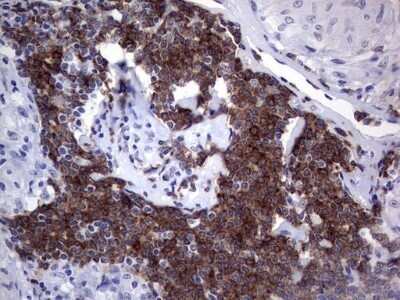 Immunohistochemistry: TFPI-2 Antibody (OTI1D4) - Azide and BSA Free [NBP2-74494]