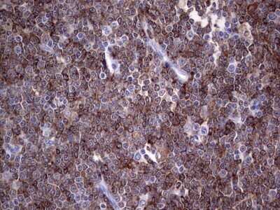 Immunohistochemistry: TFPI-2 Antibody (OTI1D4) - Azide and BSA Free [NBP2-74494]