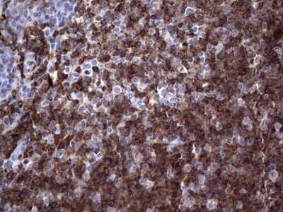 Immunohistochemistry: TFPI-2 Antibody (OTI1D4) - Azide and BSA Free [NBP2-74494]