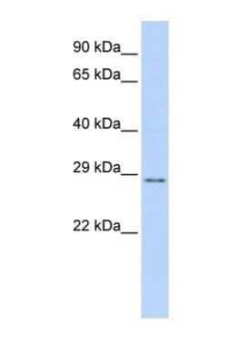 Western Blot: TFPI-2 Antibody [NBP1-57942]