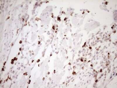 Immunohistochemistry: TFPI Antibody (OTI5H5) [NBP2-46098]