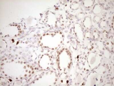 Immunohistochemistry: TFPI Antibody (OTI5H5) [NBP2-46098]