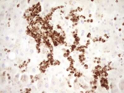 Immunohistochemistry: TFPI Antibody (OTI5H5) [NBP2-46098]