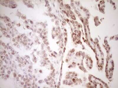 Immunohistochemistry: TFPI Antibody (OTI5H5) [NBP2-46098]