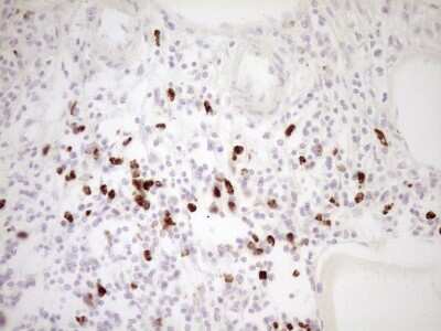 Immunohistochemistry: TFPI Antibody (OTI5H5) [NBP2-46098]