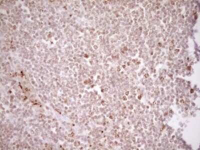 Immunohistochemistry: TFPI Antibody (OTI5H5) [NBP2-46098]