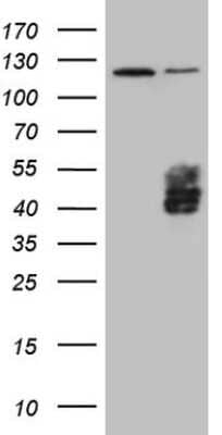 Western Blot: TFPI Antibody (OTI5H5) [NBP2-46098]