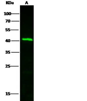 Western Blot: TFPI Antibody (6) [NBP2-89569]