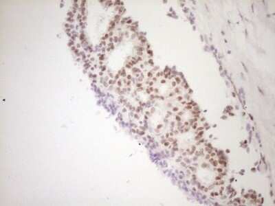 Immunohistochemistry: TFPI Antibody (OTI5H5) - Azide and BSA Free [NBP2-74493]