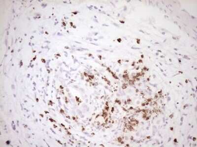 Immunohistochemistry: TFPI Antibody (OTI5H5) - Azide and BSA Free [NBP2-74493]