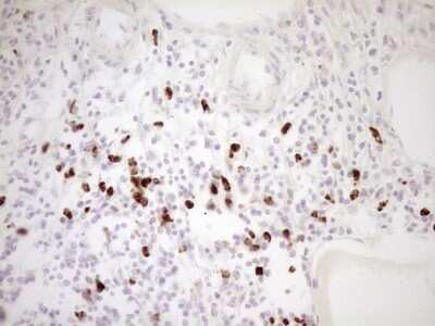 Immunohistochemistry: TFPI Antibody (OTI5H5) - Azide and BSA Free [NBP2-74493]