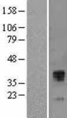 Western Blot: TFPI Overexpression Lysate [NBL1-16845]