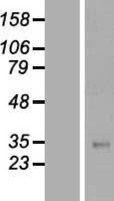 Western Blot: TFPI Overexpression Lysate [NBL1-16846]