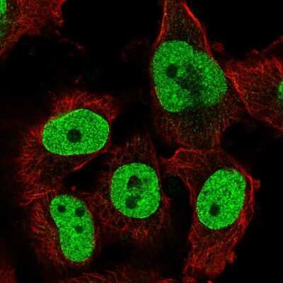 Immunocytochemistry/ Immunofluorescence: TFPT Antibody [NBP2-56080]