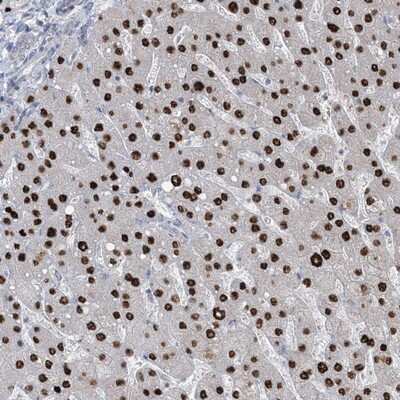 Immunohistochemistry-Paraffin: TFPT Antibody [NBP1-89106]