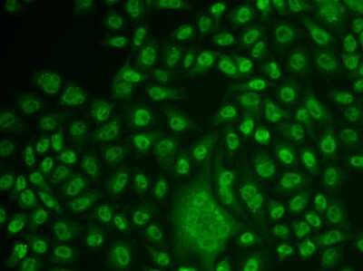 Western Blot: TFPT AntibodyBSA Free [NBP3-04589]