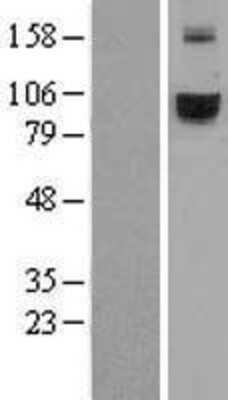 Western Blot: TfR2 Overexpression Lysate [NBL1-16849]