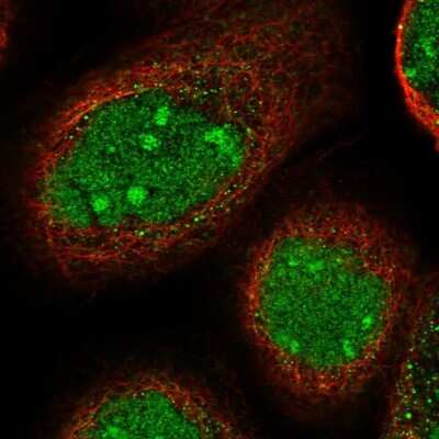 Immunocytochemistry/ Immunofluorescence: TGDS Antibody [NBP1-87063]
