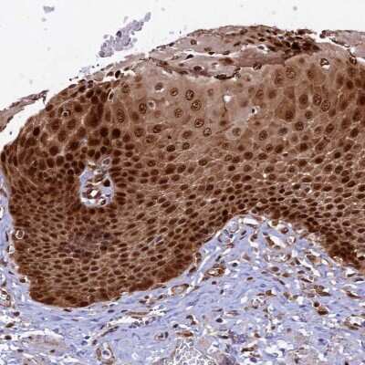 Immunohistochemistry-Paraffin: TGDS Antibody [NBP1-87064]