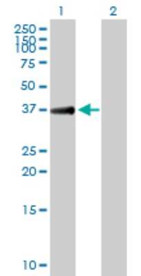 Western Blot: TGDS Antibody [H00023483-B01P]