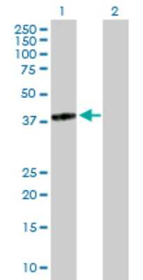 Western Blot: TGDS Antibody [H00023483-B02P]