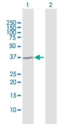 Western Blot: TGDS Antibody [H00023483-D01P]