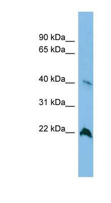 Western Blot: TGDS Antibody [NBP1-57733]