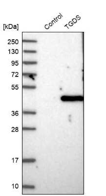 Western Blot: TGDS Antibody [NBP1-87063]