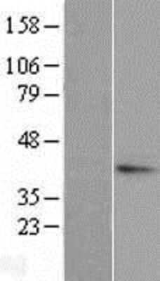 Western Blot: TGDS Overexpression Lysate [NBL1-16850]