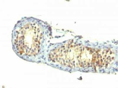 Immunohistochemistry-Paraffin: TGF-alpha Antibody (1E8-G6) - Azide and BSA Free [NBP2-34524]