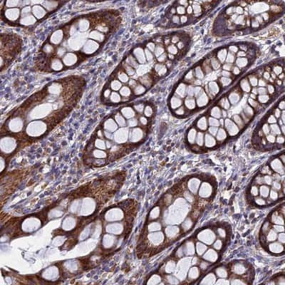 Immunohistochemistry-Paraffin: TGF-alpha Antibody [NBP1-87501]