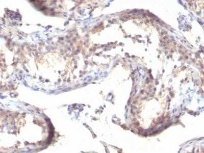 Immunohistochemistry-Paraffin: TGF-alpha Antibody (MF9) - Azide and BSA Free [NBP2-34683]