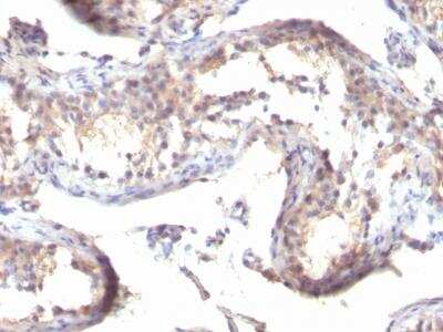 Immunohistochemistry-Paraffin: TGF-alpha Antibody (MF9) [NBP2-34296]